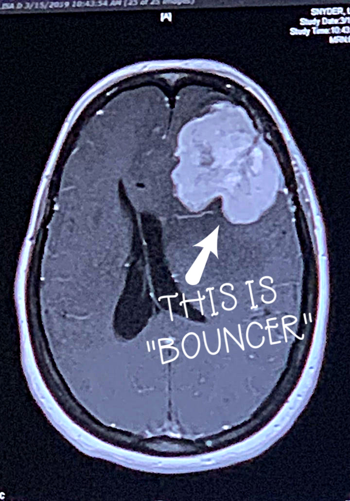 Bouncer the Brain Tumor